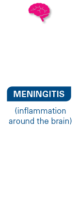 meningitis