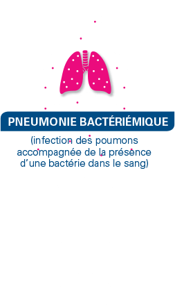 bacteraemia-pneumonia