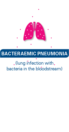 bacteraemia-pneumonia